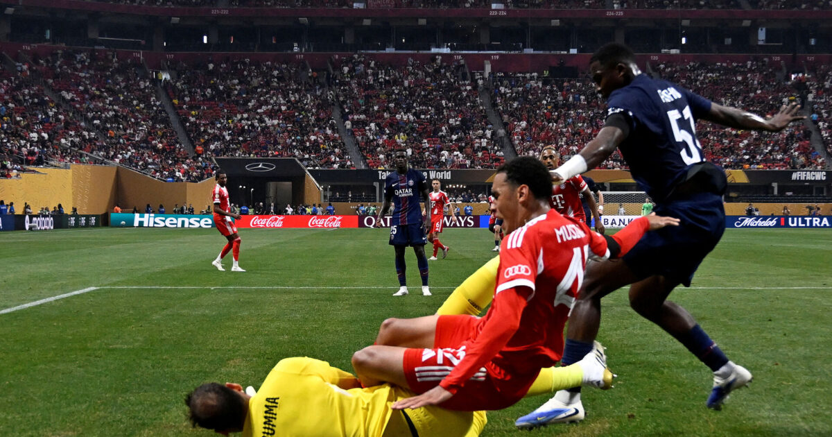 Musiala efter sammenstød og grim skade: Ingen skal have skylden Foto: Pablo Morano/REUTERS