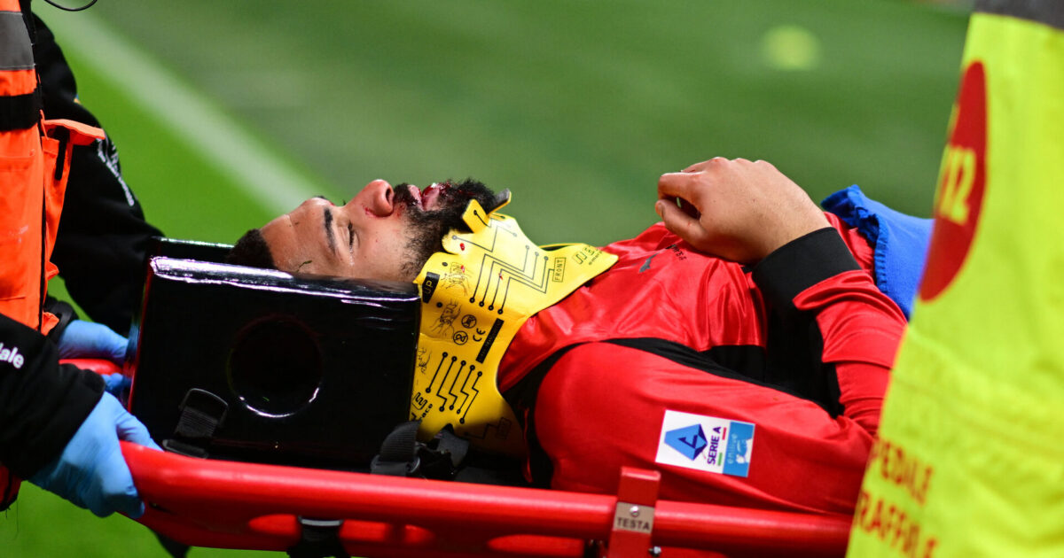 Medie: Milan-stjerne har brækket kæben Foto: Daniele Mascolo/REUTERS