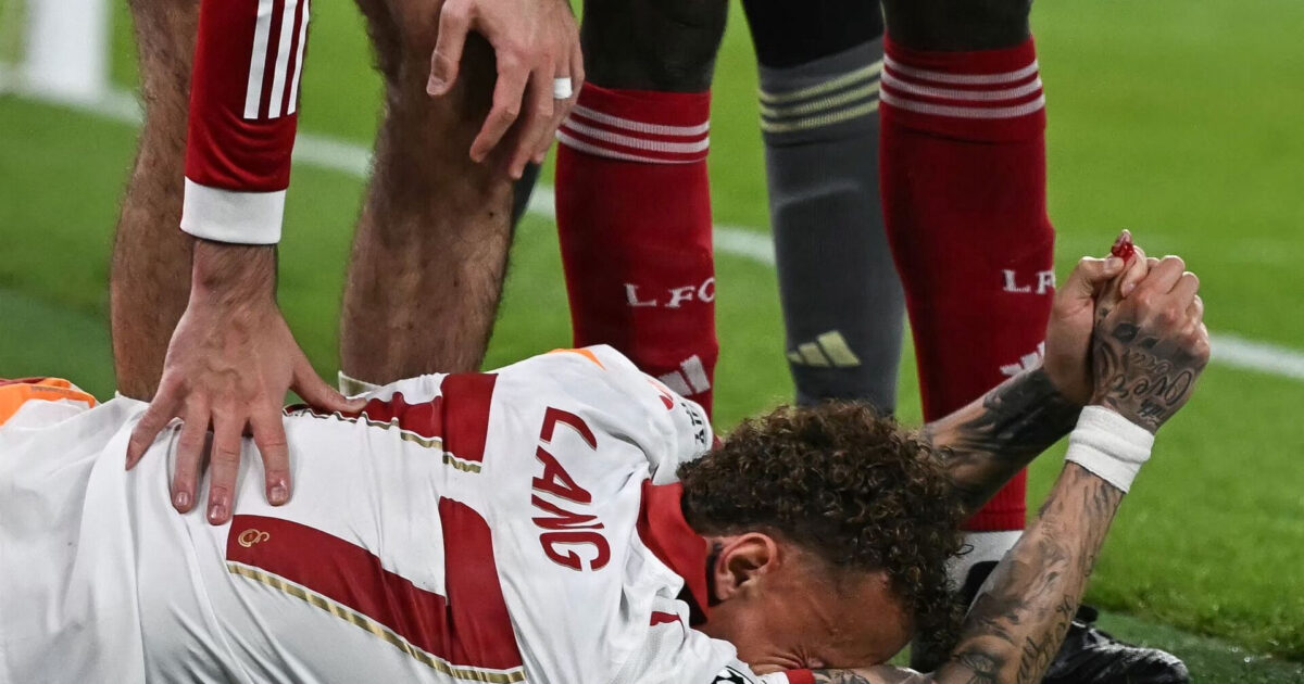 Brækket arm og snitsår: Galatasaray opdaterer Foto: Paul Ellis/AFP/Ritzau Scanpix